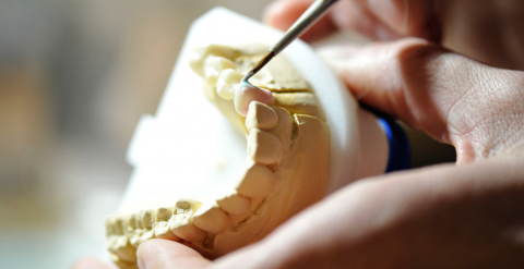 Beratung über Implantologie in der Zahnarztpraxis bei Moers